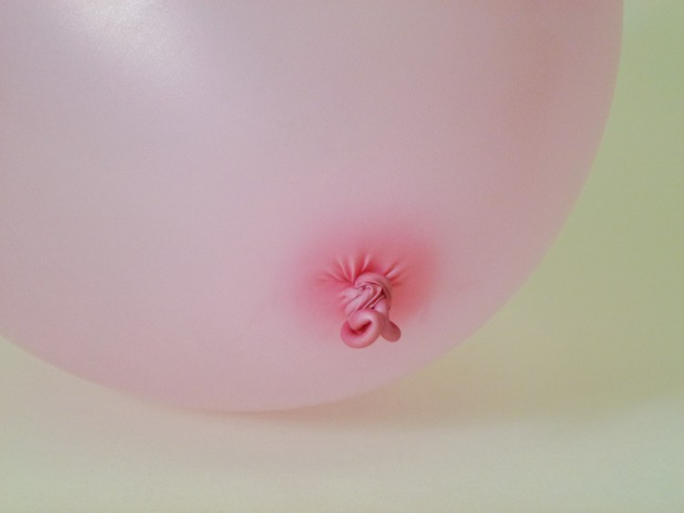 Hope Leaves The Body Slowly  Day 13