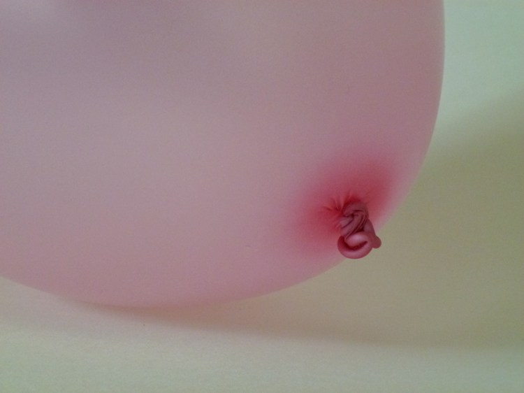 Hope Leaves The Body Slowly  Day 3