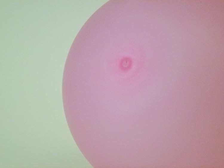 Hope Leaves The Body Slowly  Day 5